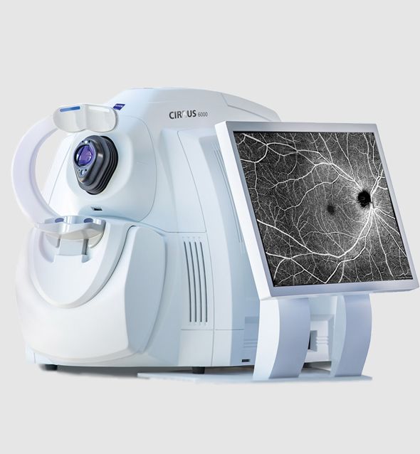 OCT : la Tomographie à Cohérence Optique - Centre ophtalmologique COSS à Brétigny-sur-Orge - Essoune